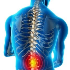 Pain-Back Pain